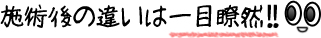 施術後の違いは一目瞭然！